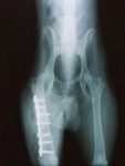 Onemocnn kloub, zlomeniny kost - osteosyntzy